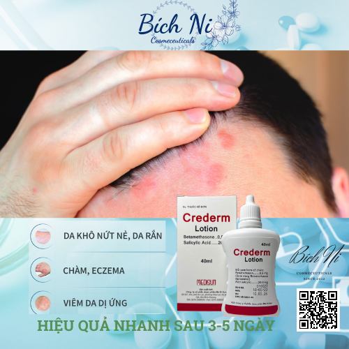 Crederm lotion 40ml dung dịch chăm sóc da Chàm, Vẩy nến, Nấm da đầu