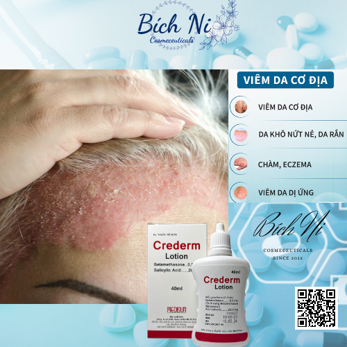 Crederm lotion 40ml dung dịch chăm sóc da Chàm, Vẩy nến, Nấm da đầu