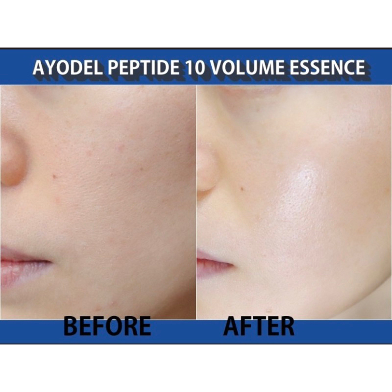 Tinh chất Botox detox Peptide 10 Ayodele 100ml