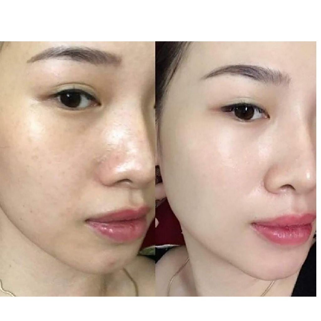 Kem Chống Nắng MartiDerm The Originals Proteos Screen Phổ Rộng Toàn Diện Cho Mọi Loại Da 40ml SPF50+