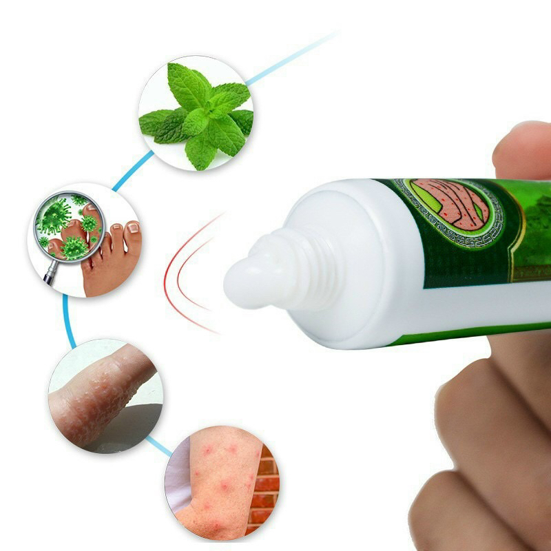 💥💥💥Kem Eczema Cream❄️❄️❄️