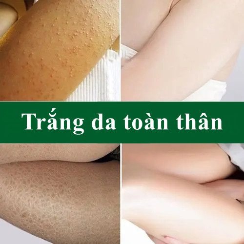 Kem tẩy tế bào chết body/da đầu tẩy tế bào chết da mặt da dầu mụn 250g tẩy tbc thu nhỏ lỗ chân lông