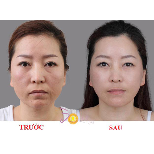 Kem ốc sên dưỡng trắng da Goodal Premium Snail Tone Up Cream - 30g