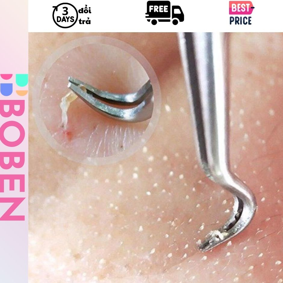 Nhíp cong gắp mụn Nhíp lấy mụn đầu đen