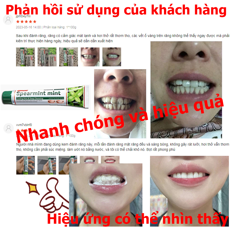 Kem Đánh Răng Làm Trắng Răng loại bỏ cao răng hôi miệng tẩy ố vàng 100g Sửa chữa nướu răng giảm sâu răng