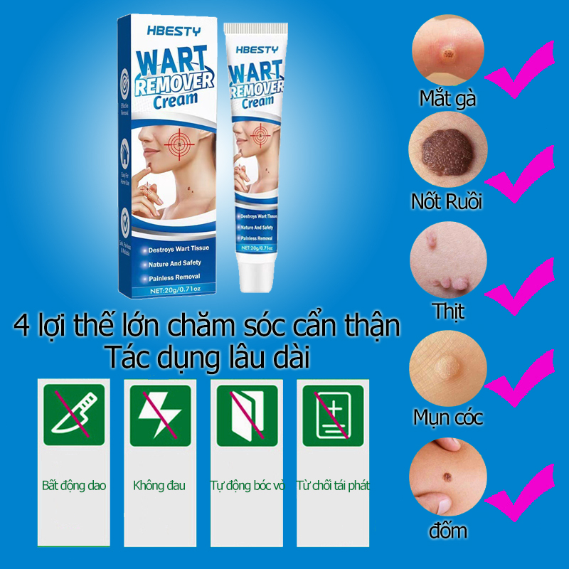 Kem Loại Bỏ Mụn Và Nốt Ruồi 20g xóa nốt ruồi mụn cóc mụn thịt sạch mụn thịt thừa mụn thịt tàn nhang