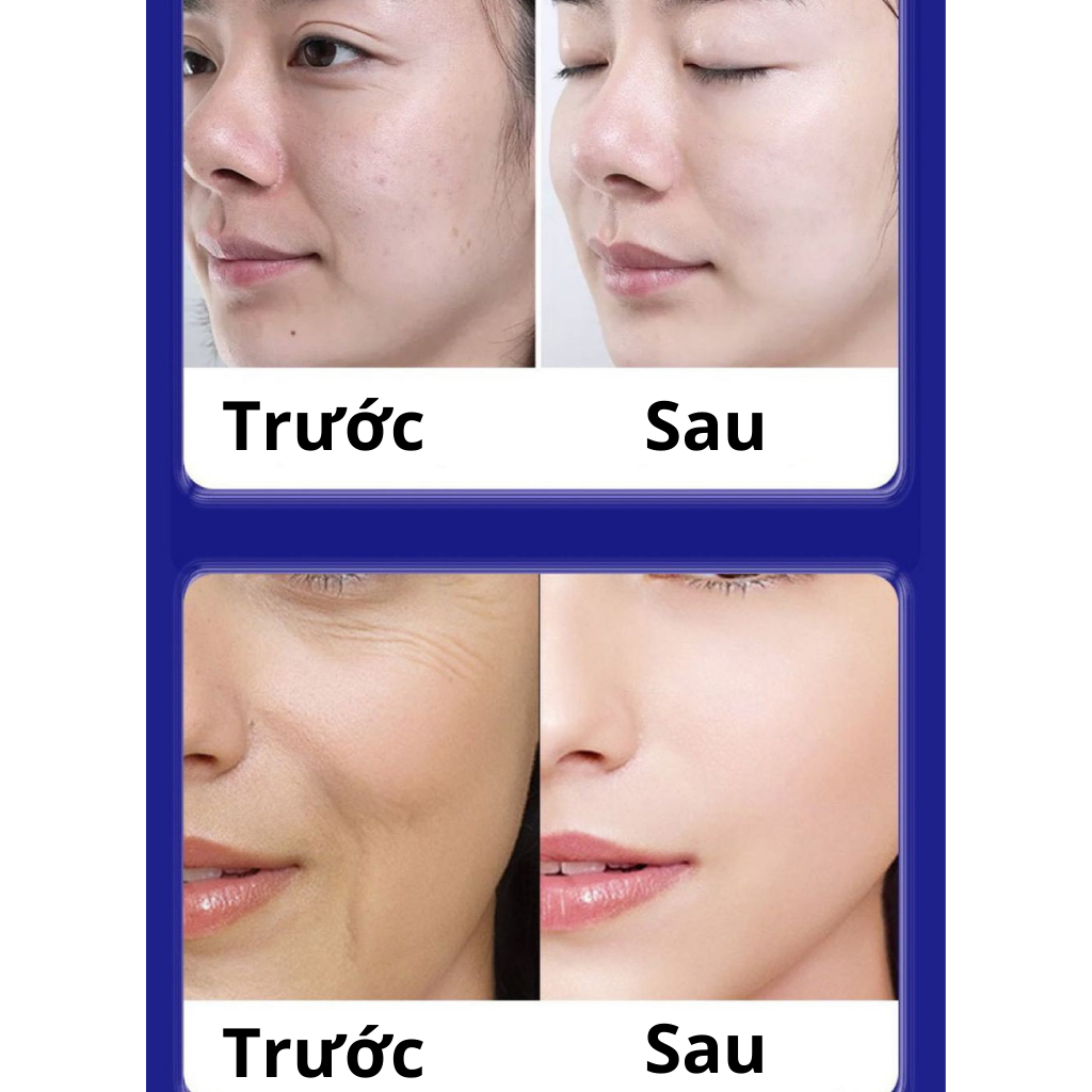 Kem UCM xóa nhăn, mờ nám trẻ hóa làn da nội địa nhật