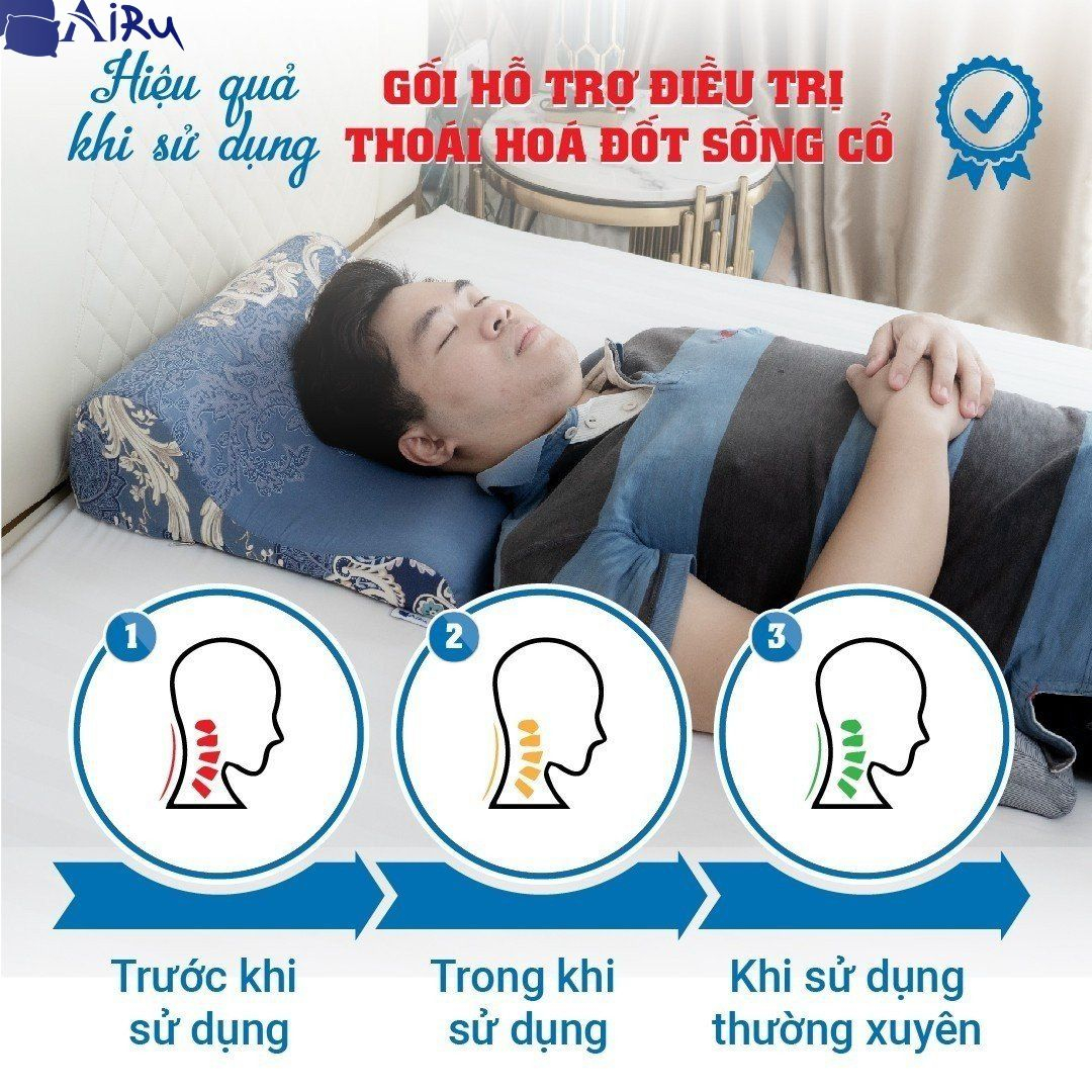 Gối hỗ trợ điều trị thoái hóa cột sống cổ-Thương hiệu AIRU