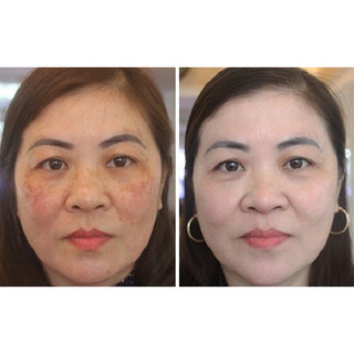KEM CCM COLLAGEN NHÂN SÂM
