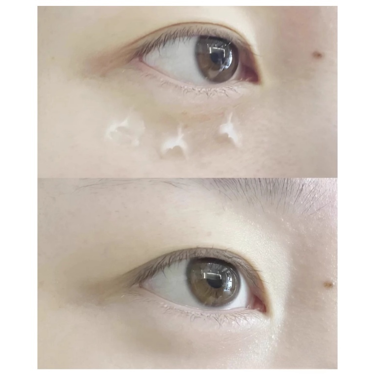 Kem dưỡng mắt Lancome Genifique Yeux Eye Cream 15ml
