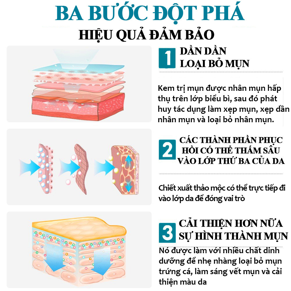 Kem thâm mụn 30g gel ngừa mụn dưỡng ẩm làm sáng da làn da mịn màng dùng cho mụn viêm, mụn bọc, mụn mủ, mụn trứng cá