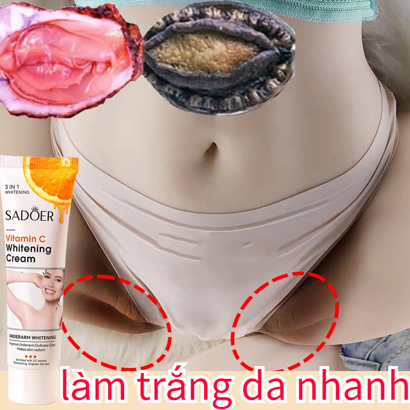 Kem làm trắng vùng kín sữa dưỡng thể trắng da 50g cổ nách cánh tay đầu gối nhanh Làm sáng màu da loại bỏ hắc tố