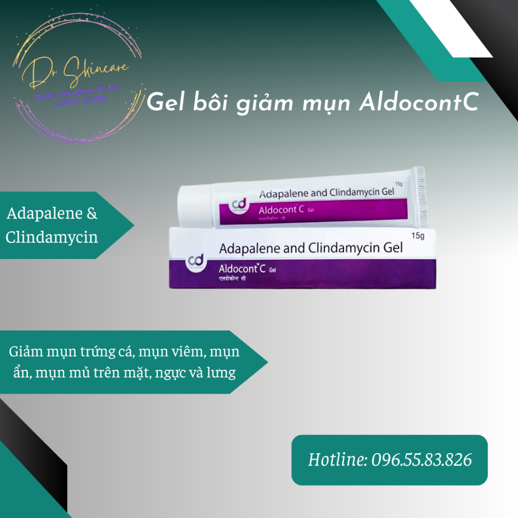 Kem chấm mụn Aldocont C - Clindamycin & Adapalene
