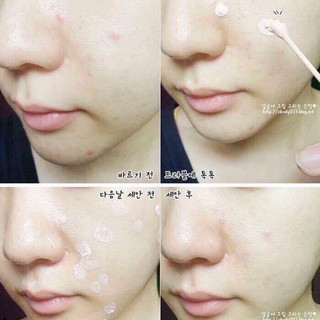 (29ml) Dung Dịch Chấm Mụn Mario Badescu Drying Lotion