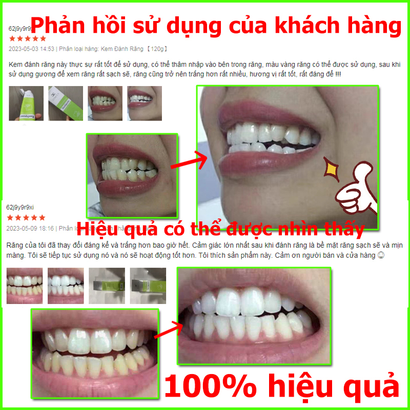 Kem Đánh Răng Làm Trắng Răng Kem đánh trắng răng 120g Giảm Vết Ố Vàng Trên Răng giảm sâu răng Giữ Hơi Thở Thơm Mát