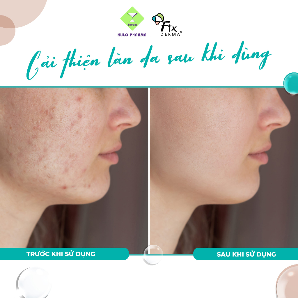 Sữa Rửa Mặt Tẩy Tế Bào Chết FIXDERMA Peelonate BHA Alternate Day Peeling Face Cleanser Làm Sạch Sâu 100ml