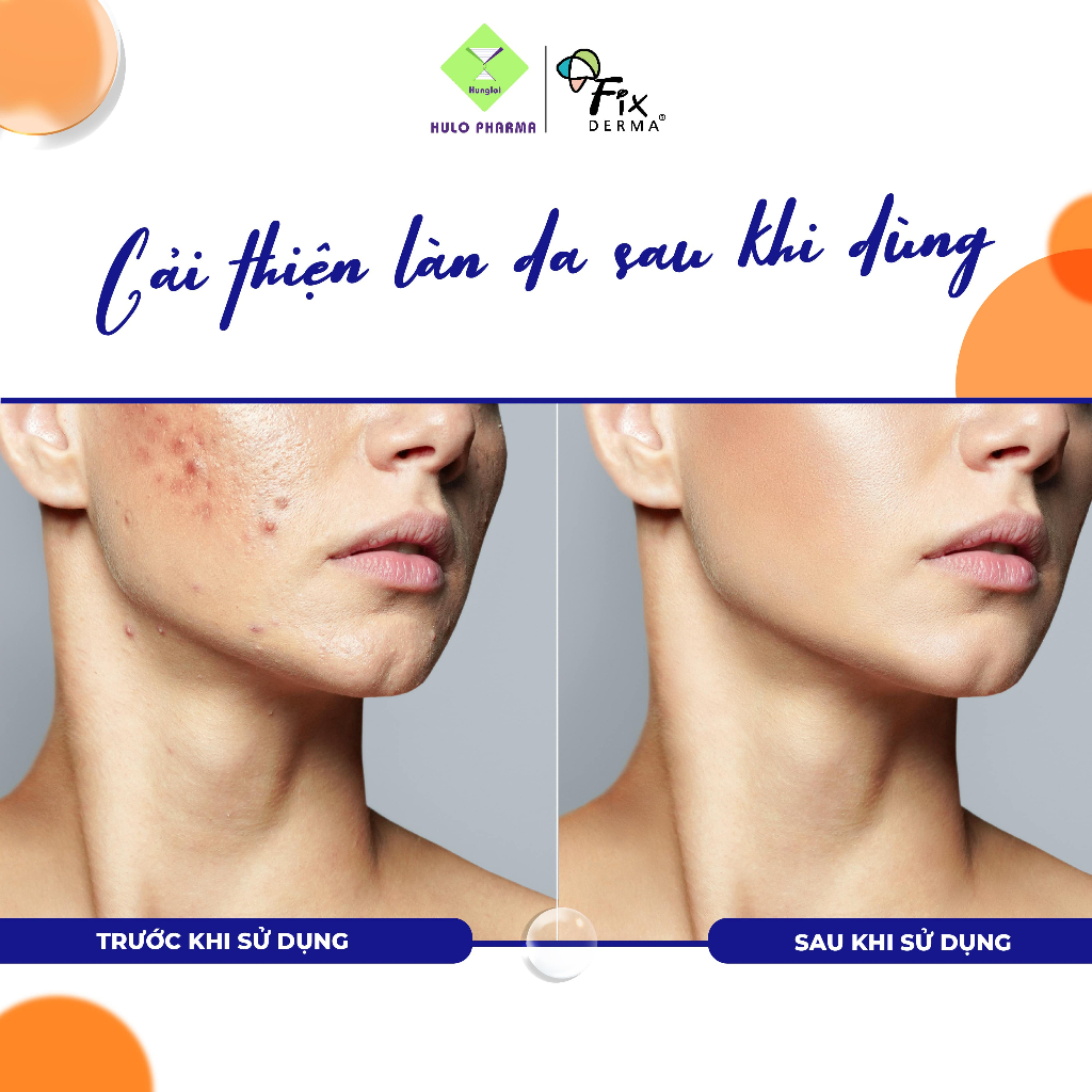 Chấm Mụn FIXDERMA Salyzap Lotion For Acne Night Time Giúp Ngăn Ngừa Mụn và Giảm Thâm Mụn Dành Cho Ban Đêm 20g