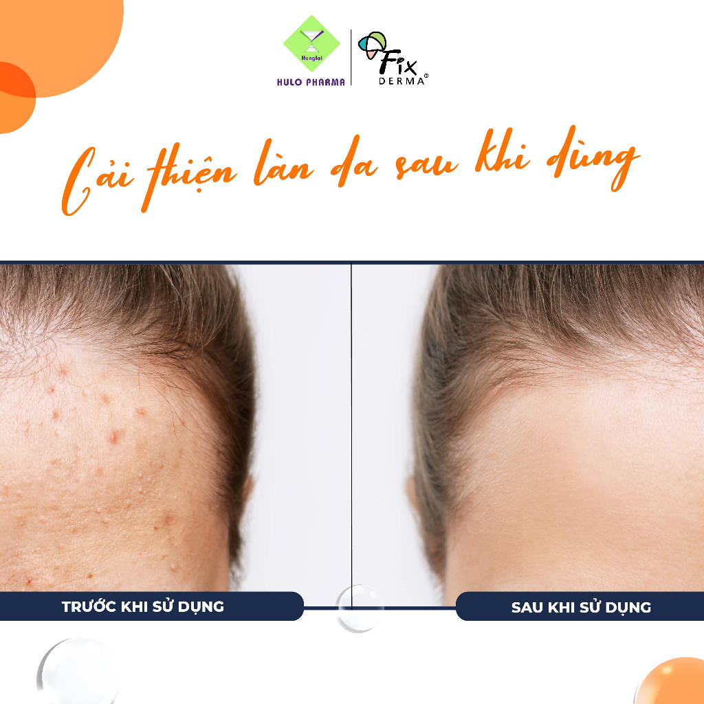 Chấm Mụn FIXDERMA Salyzap Gel For Acne Day Time Giảm Thâm Mụn, Mờ Sẹo Dành Cho Ban Ngày 20g