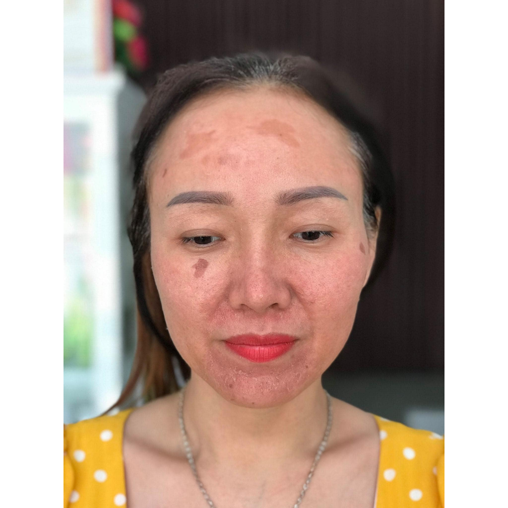 Tinh Chất Đào Thải Chân Nám và Trẻ Hoá Da SKINTOX- DIMANLAIER