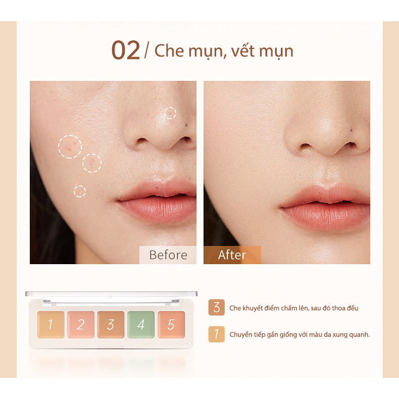 Hộp che khuyết điểm Focallure Hộp che khuyết điểm 5 màu Che khuyết điểm đen mụn 4.3g