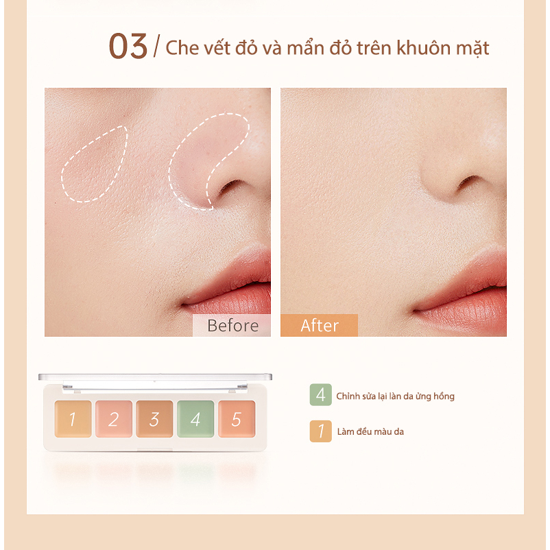 Hộp che khuyết điểm Focallure Hộp che khuyết điểm 5 màu Che khuyết điểm đen mụn 4.3g