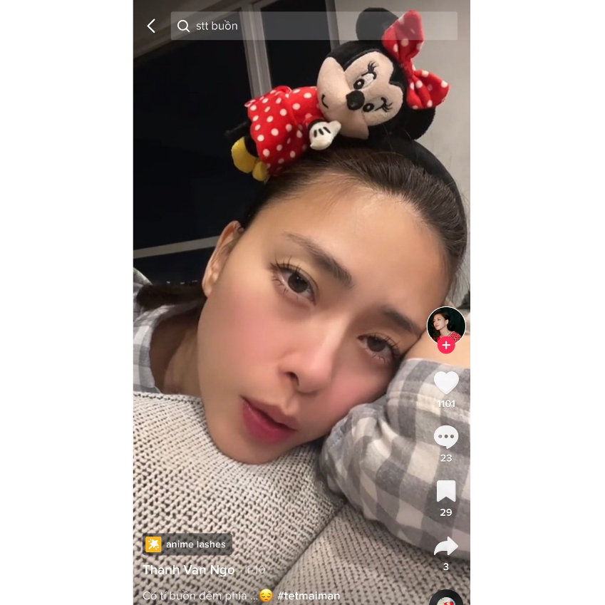 Bờm tóc Mickey siêu xinh