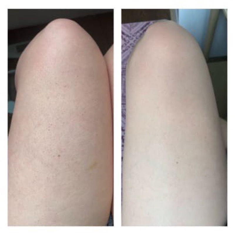Kem dưỡng thể làm mịn da, sáng da, giảm viêm lỗ chân lông Weightless Body Treatment With 2% BHA 210ml