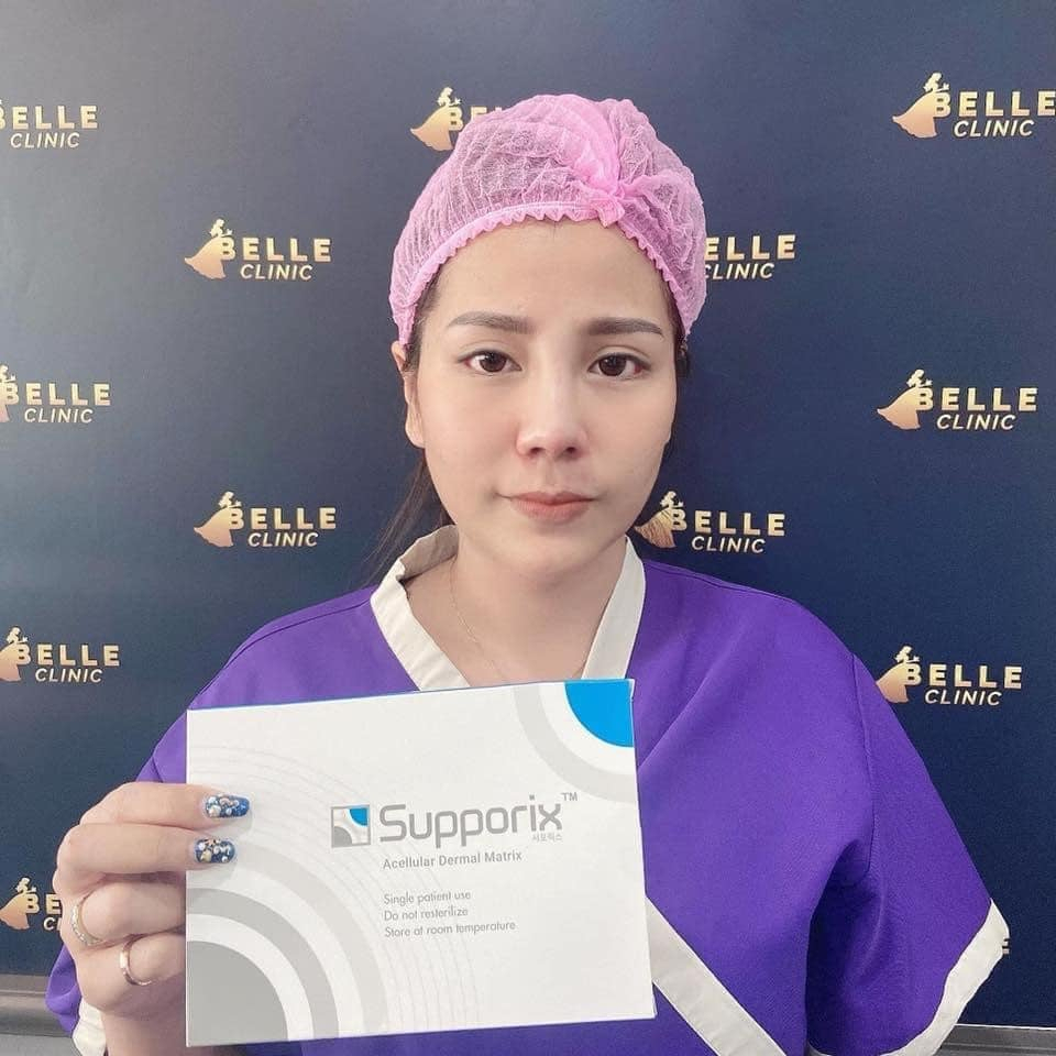 Bọc đầu mũi cao cấp Supporix Korea