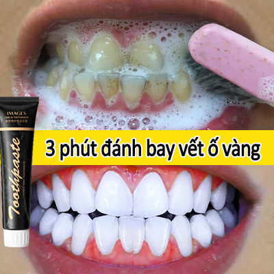Kem đánh răng làm trắng kem đánh răng 85g than hoạt tính loại bỏ vết bẩn kháng khuẩn làm trắng răng dịu độ nhạy cảm
