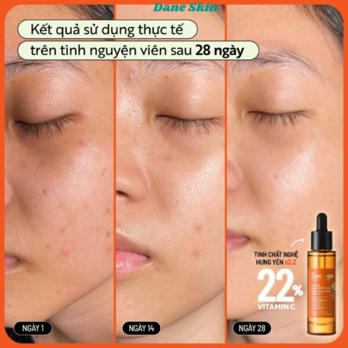 Tinh chất nghệ Hưng Yên x2.2 (serum) với 22% vitamin C sáng da chuyên sâu & mờ vết thâm Cocoon 5ml