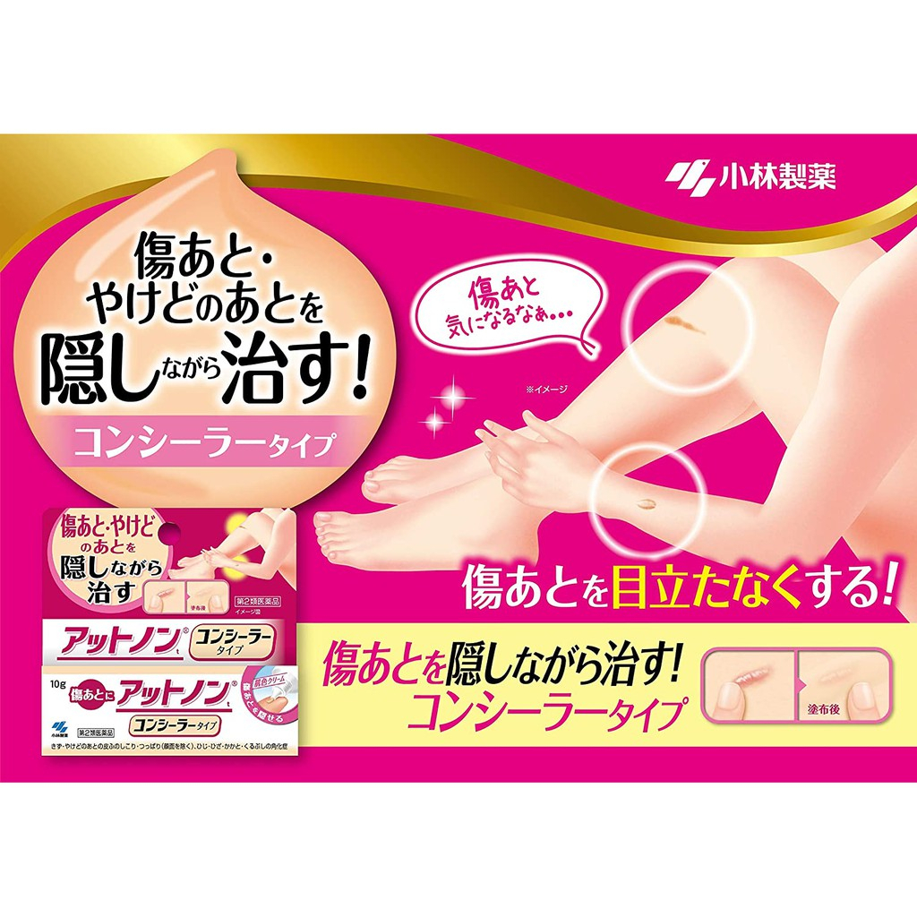 Kem mờ sẹo Kobayashi EX Nhật Bản 15g