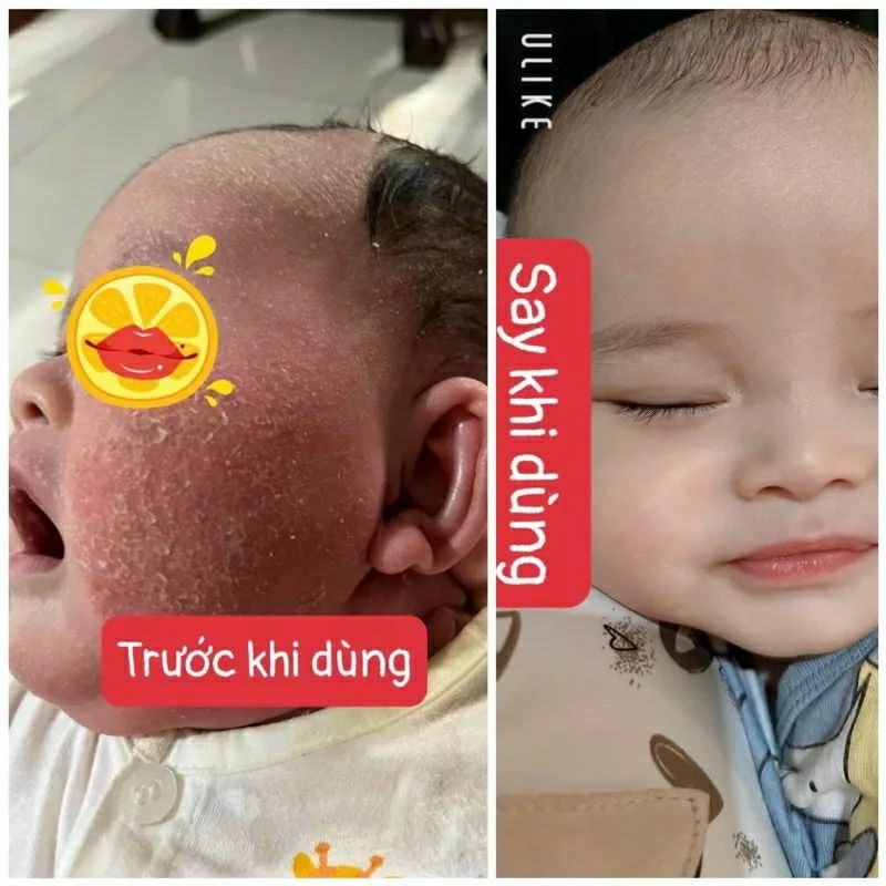 Kem Bôi Da Minh Hùng chính hãng