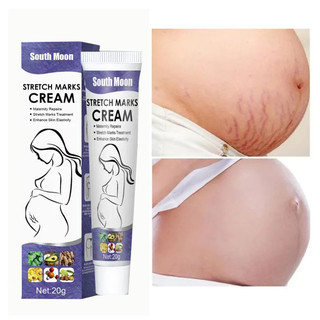 (HCM)South Noon Kem làm mờ rạn da, kem tái tạo da hiệu quả cho bà bầu Anti-stretch Marks Cream - mờ sẹo, giảm thâm, giảm