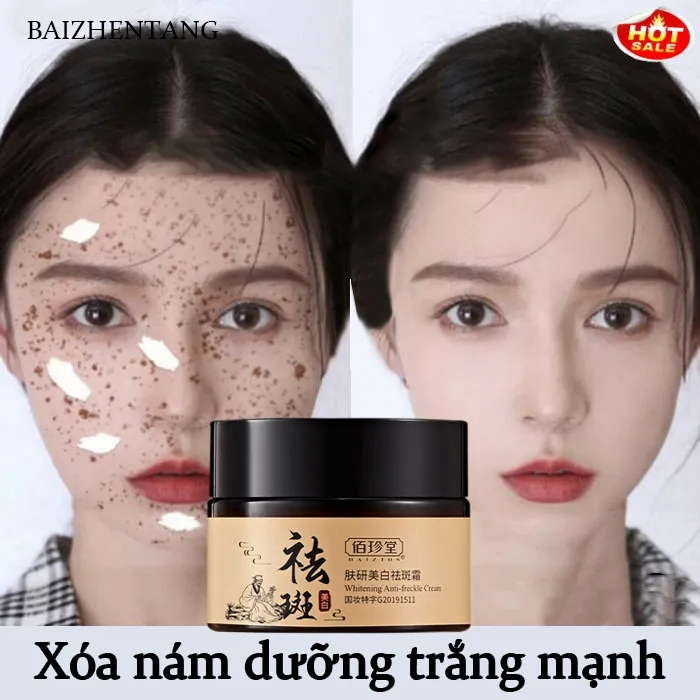 Kem nám và chống tàn nhang thảo dược BAIZTON 30g da trắng sáng và dưỡng ẩm - Hiệu quả chỉ 28 ngày sử dụng A189