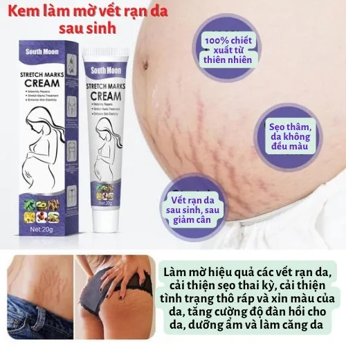 South Noon Kem làm mờ rạn da, kem tái tạo da hiệu quả cho bà bầu Anti-stretch Marks Cream - mờ sẹo, giảm thâm, giảm