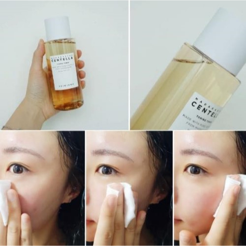 Nước hoa hồng Skin1004 Madagascar Centella Toning Toner 210ml