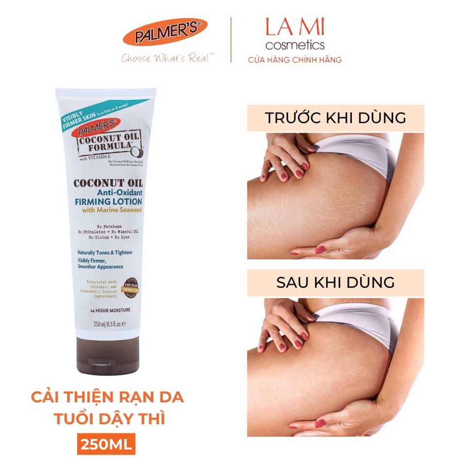 [26/11/24] Lotion săn chắc, ngăn ngừa rạn da tuổi dậy thì Palmer's (Vùng mông, đùi, bắp tay) 250ml