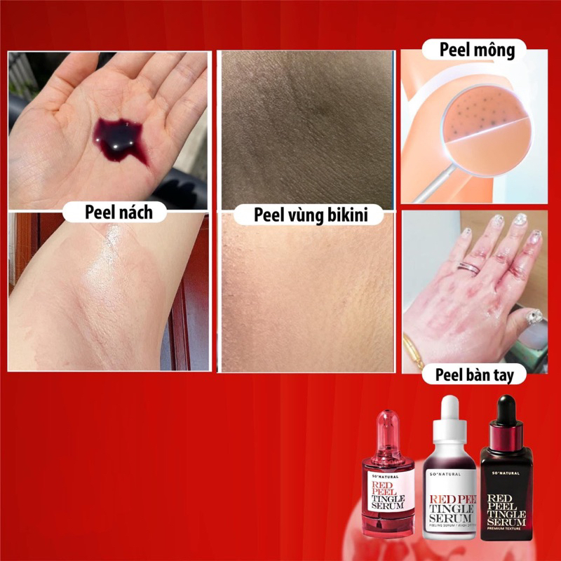 Peel Da Sinh Học Red Peel Tingle Serum 10ml Giúp Tái Tạo Tẩy Da Chết Dương Trắng Da Mịn Màng Căng Bóng