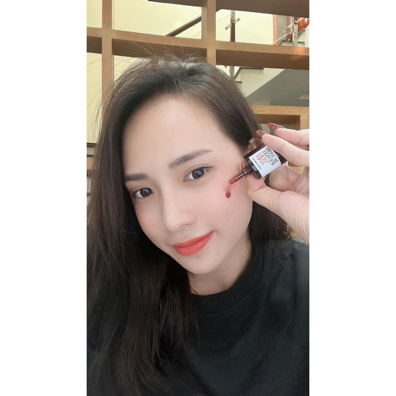 Peel Da Sinh Học Red Peel Tingle Serum 10ml Giúp Tái Tạo Tẩy Da Chết Dương Trắng Da Mịn Màng Căng Bóng