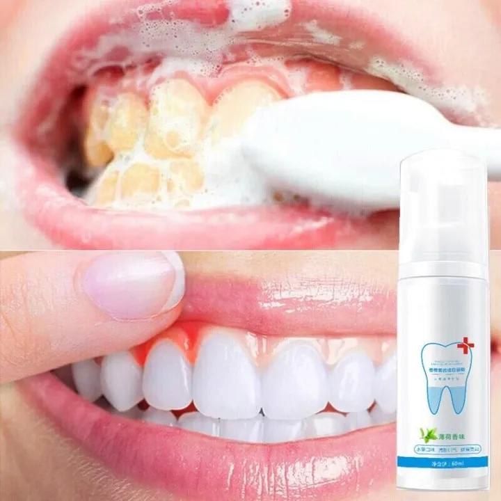 Bọt Kem đánh răng chuyên làm trắng nhanhvệ sinh răng miệng loại bỏ mảng bám vết bẩnkem đánh rặngkem trắng rănglàm
