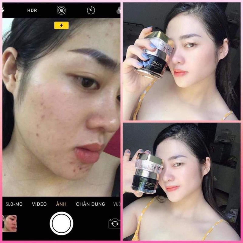 Combo kem Elemis ngày đêm