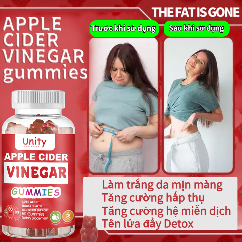 Giấm táo mềm Hai viên mỗi ngày nhanh chóng đốt mỡ, giảm cân thần tốc, người lười giảm cân, mặt gầy, chân gầy
