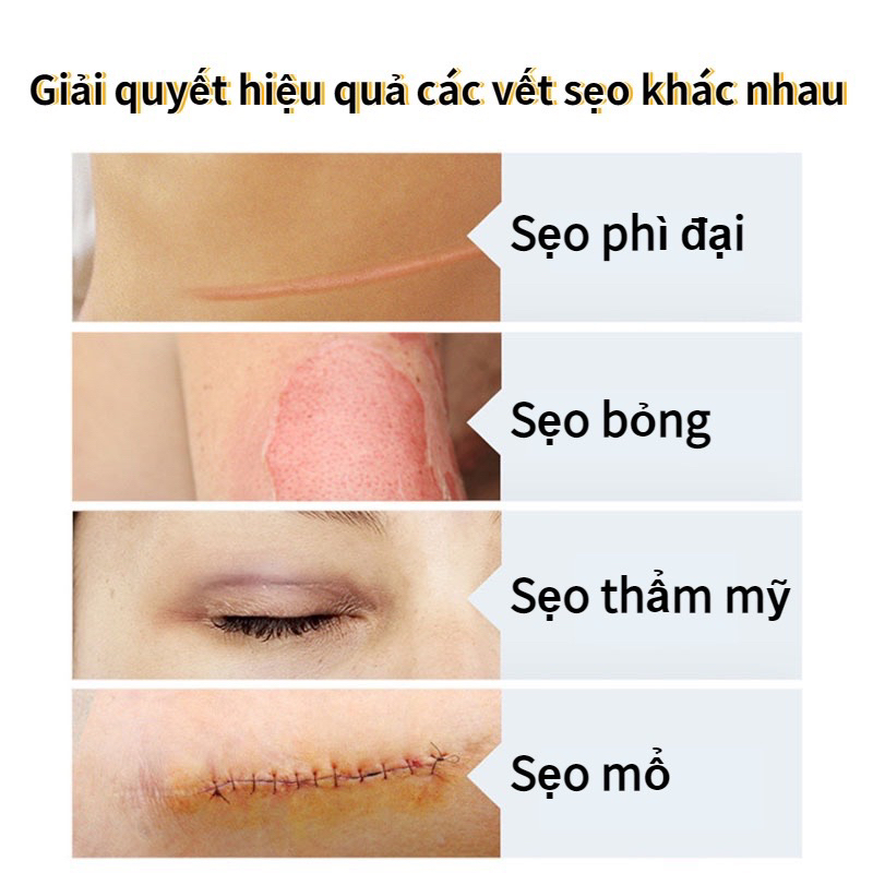 Full hộp 3 Miếng dán silicone mờ sẹo lồi, sẹo thâm lâu năm nhanh giúp làm giảm sẹo