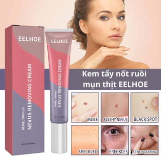Gel tẩy nốt ruồi mụn cóc thịt tàn nhang cơm hạt ruồi