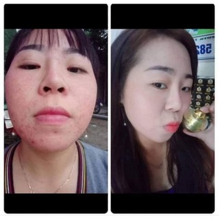 KEM FACE CHUYÊN MỤN HUỲNH ĐỖ