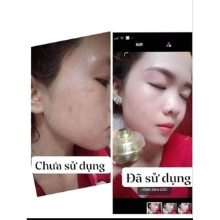 KEM FACE CHUYÊN MỤN HUỲNH ĐỖ