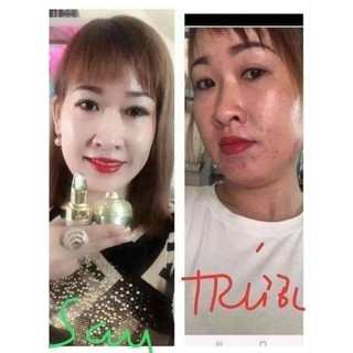 KEM FACE CHUYÊN MỤN HUỲNH ĐỖ
