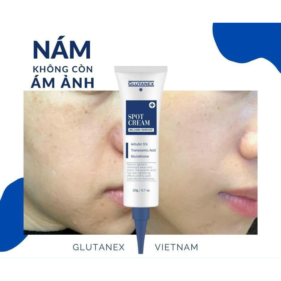 Kem mờ nám  Arbutin 5%, Tranexxamic acid, Glutathione, Glutanex Spot Cream Melasma Remover 20g