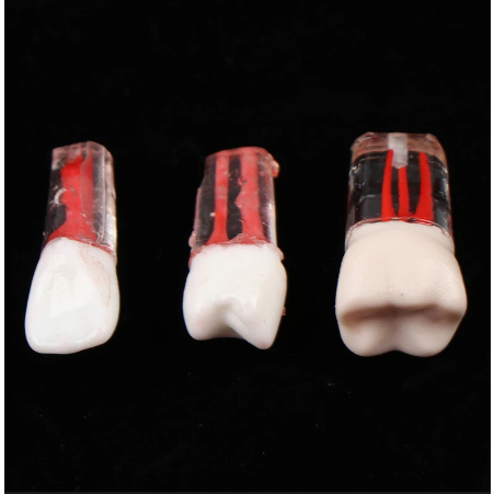 Mô hình răng giả bằng nhựa và resin dành cho nha sĩ thực hành nội nha và phục hình, có chốt cắm vít trên mẫu hàm