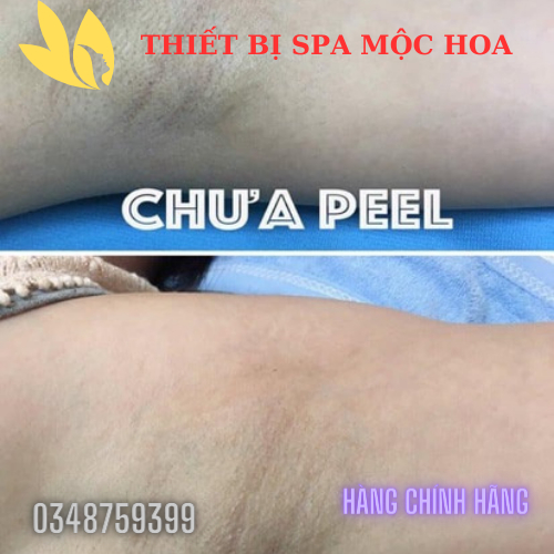 PEEL TCA Hỗ Trợ Làm Giảm Thâm Nách Bikini Làm Hồng Nhũ Hoa, Mông Bẹn